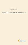 Über Schenkelhalsfrakturen (German Edition) - Paul Leipolz 