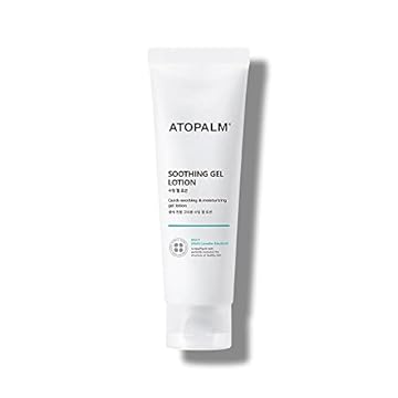 best heat rash lotion