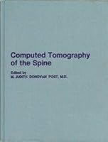 Computed Tomography of the Spine 0683069519 Book Cover