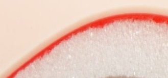 Suturing Doctor Pads 2pc Set - Flesh Skin-Tone Colour with Free 12 x Needles and Free 1 x Needle Holder - Start Practicing Straight Away! As seen on The BBC TV - Thumbnail 4