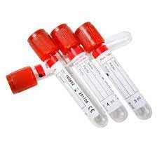 Non-Vacuum Blood Collection Tube Clot Activator, Red Top - 4ml, Pack of 100 Tubes | High-Quality Blood Sample Collection Tubes (B0CMJ4GSBS) Amazon Price History, Amazon Price Tracker