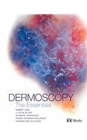Dermoscopy: The Essentials