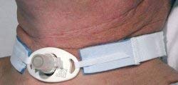 AirLife Tracheostomy Tube Holder, RES240A - Case of 100