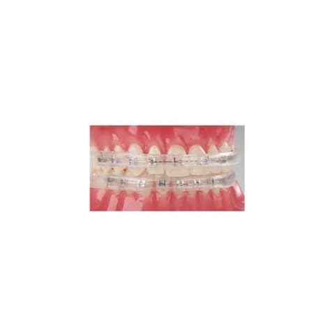 Comfort Lip Shield/Mouth Guard - for Orthodontic- Dental Braces by CAYENAS Cover