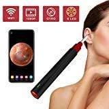 1080P FHD Wireless Ear Scope, Super Light Lens WiFi Ear Endoscope, Ear Otoscope Camera with 3-Axis Gyroscope, Ear Wax Removal Endoscope, Compatible with Smartphone and Tablet, Ear Camera
