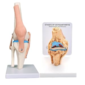 Kay Kay Industries Human Life Size Knee Joint Model and Human Mini Arthritic Knee Model Set | Hinghly Detailed and accurate Perfect for Medical Professionals and Training (B08F2VCN9Q) Amazon Price History, Amazon Price Tracker