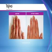 Trind Keratin Restorer, Nail Strengthener for Damaged Nails 9ml