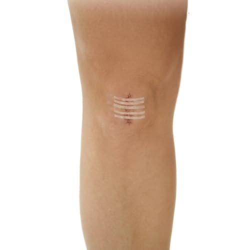 Image of CURAD Sterile Medi-Strips Reinforced Wound Closures, 1 /4 inch x 4 inch, Hypoallergenic, Pack of 10 Strips