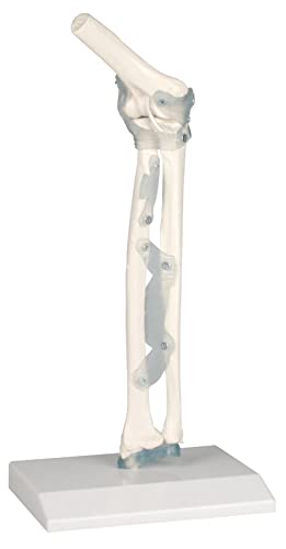 4556 Erler Zimmer gomitiere snodo con nastrini