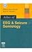 Atlas of EEG & Seizure Semiology: Text with DVD