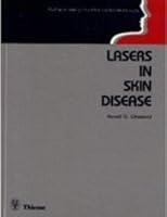 Lasers in Skin Disease 0865772711 Book Cover