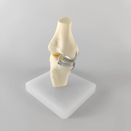 Modèle d'articulation du genou pour remplacement total et éducation des patients - 5