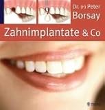  Zahnimplantate & Co.. Die Implantologie in der modernen Zahnheilkunde