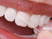 POH Classic 490 NOWAX Floss (unwaxed) 100 Yards - 12/Pack