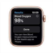 Amazon.com: Apple Watch Series 6 (GPS + Cellular, 44mm) Gold