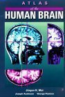 Atlas of the Human Brain: 9780124653610: Medicine & Health Science ...