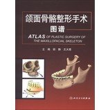Atlas of Plastic Surgery of the Maxillofacial skeletonChinese Edition