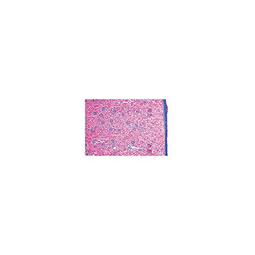Image of 3B Scientific GmbH W13315 Urinary System-German