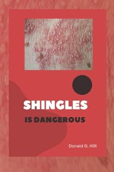 Shingles