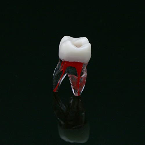 Debksgeoti DEBKSGEOTI-M8008-36#-10 Dental Root Canal Pulp Cavity Practice Endodontic Pulp-Opened Rct Teeth Model M8008 16# Typodont Standard 1:1 Teach Study 5 Pcs thumb #2