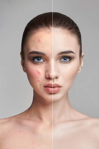 Look Ten Years Younger Effective Secrets - 2020 Therapy: Most Common Skin care