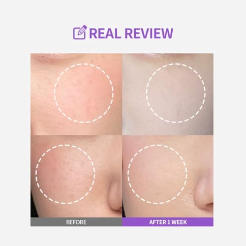 Image of SUNGBOON EDITOR Meoru Podo Vita C Dark Spot Ampoule 30ml | Korean Face Serum with Vitamin C, Niacinamide & Hyaluronic Acid | Dark Spot Corrector, Brightening Serum, Hyperpigmentation, Uneven Skin Tone & Glow Care