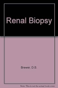 Hardcover Renal biopsy Book