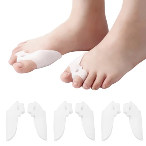 6 pcs corrector de juanetes, soporte de silicona para hallux valgus, separador de dedos, reduce el dolor de juanetes, para mujeres y hombres