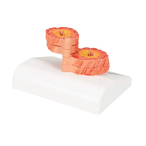 Image of 3B Scientific G50 /1 COPD Model - 3B Smart Anatomy