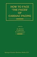How to Face 'the Faces' of Cardiac Pacing 0792315286 Book Cover
