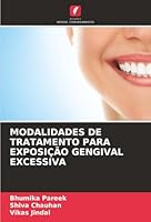 Modalidades de Tratamento Para Exposição Gengival Excessiva (Portuguese Edition) 6208971217 Book Cover