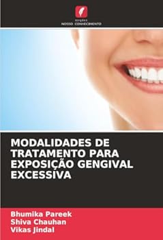 Modalidades de Tratamento Para Exposição Gengival Excessiva (Portuguese Edition)
