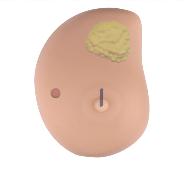 Modèle de cancer de poitrine en silicone pour examen de nodule mammaire