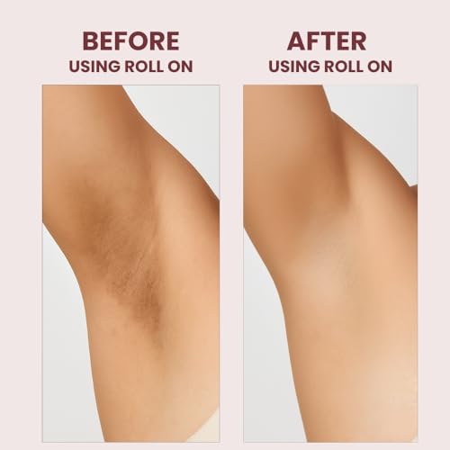 Image of Carbamide Forte Underarm Roll On with 6% AHA BHA Mandelic, Salicylic, and Lactic Acid | Prevents Body Odour, Fades Pigmentation | Underarm Roll On for Women & Men - 50ml
