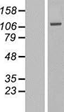 LYAG/GAA Overexpression Lysate