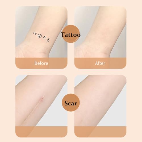 Tattoo Cover Up Tape, Ultra-Thin Coverage Invisible Stickers, Flesh-Colored Birthmarks Scars Stickers Waterproof Natural Concealer Stickers,6 Count (Pack Of 1)