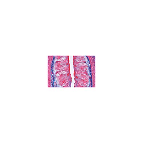 Image of 3B Scientific GmbH W13318S Sensory Organ -Spanish