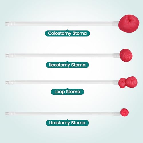 Image of Wearable Ostomy Care Trainer Kit,Stoma Models for Medical Education, Ostomy Practice Model Kit for Teaching Demonstration