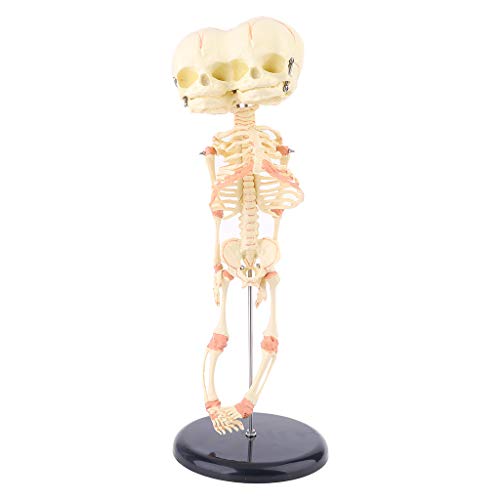 BEIDUOYANG Human Baby Deformed for Head Skull Research Model Skeleton Anatomical Anat Human Skull Model Life Size, As Described
