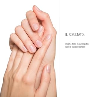 vitabay Shea Nail Butter, crema per unghie con biotina/vitamina H e burro di karitè contro unghie fragili e cuticole secche e screpolate, Burro Di Karité Per Le Unghie, 20 ml (confezione da 1)