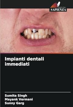 Paperback Impianti dentali immediati [Italian] Book