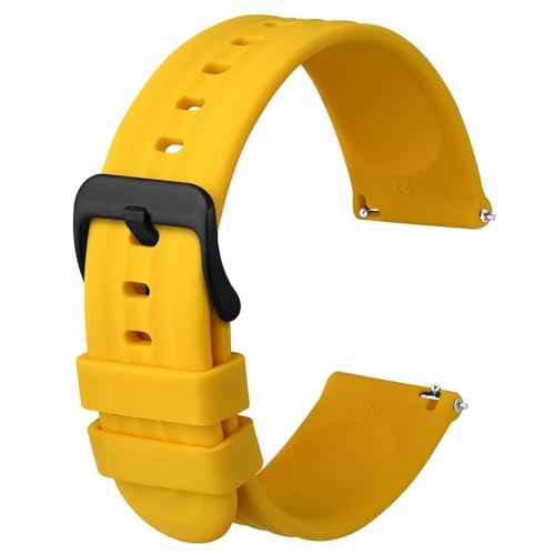 [Anbeer] 20mm voh VR rvxg Quick Release ւoh jp p O XeXX`[obN