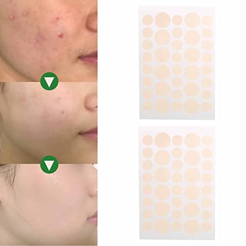 Adesivos para acne, 144 adesivos para acne que são à prova d'água e seguros para viajar para casa
