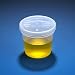 Globe Scientific 5917 Specimen Container with Separate Snap Cap, PP, Graduated, 5oz, 70mm Diameter, 67.7mm Height, Pack of 300