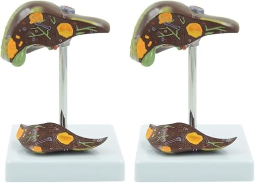 HEQIM Skeleton Models, Human Models, Life-Size Liver Anatomical Models, Pancreas Models for Medical Research and Teaching(2 Pack)