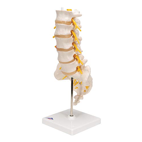 Image of 3B Scientific A76 /5 Lumbar Spinal Column with Dorso-Lateral Prolapsed Intervertebral Disc, 13.4 inch Height