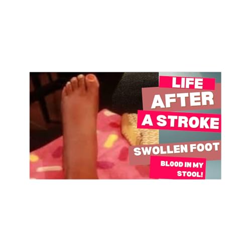 LIFE AFTER A STROKE: USC HOSPITAL ARCADIA TRYING TO INSINUATE I&rsquo;M CRAZY TO REFUSE ACCOUNTABILITY Podcast Por  arte de p