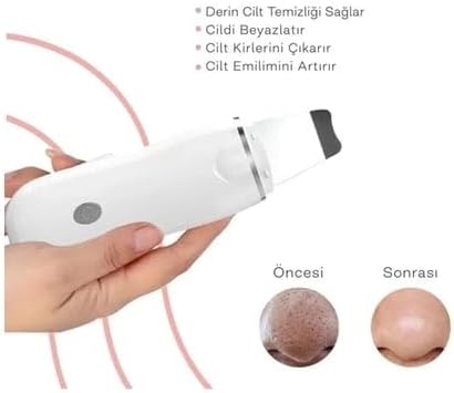 Ultrasonik Spatula Yüz Akne Giderici Siyah Nokta Temizleme Cihazı