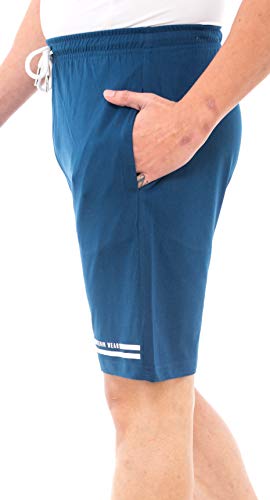 Image of Epoxy Men's Combo Shorts Pack - Sports, Gym, and Bermuda Shorts for Men - Pack of 2 - Cotton Fabric, Zipper Pocket, and Stylish Design - Summer Wear and Fitness Essentials