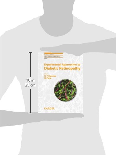 Experimental Approaches to Diabetic Retinopathy (Frontiers in Diabetes)